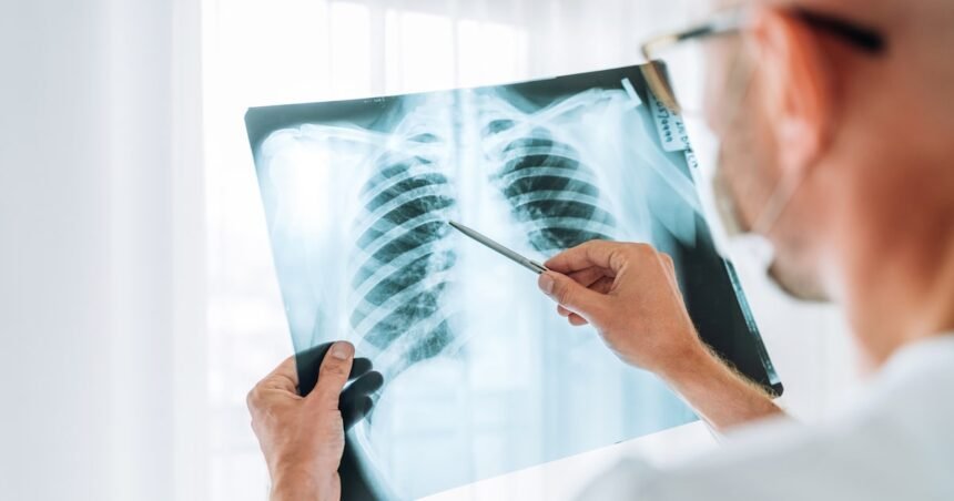 Sequelas pulmonares pós-covid podem progredir dois anos após alta hospitalar, aponta pesquisa da USP